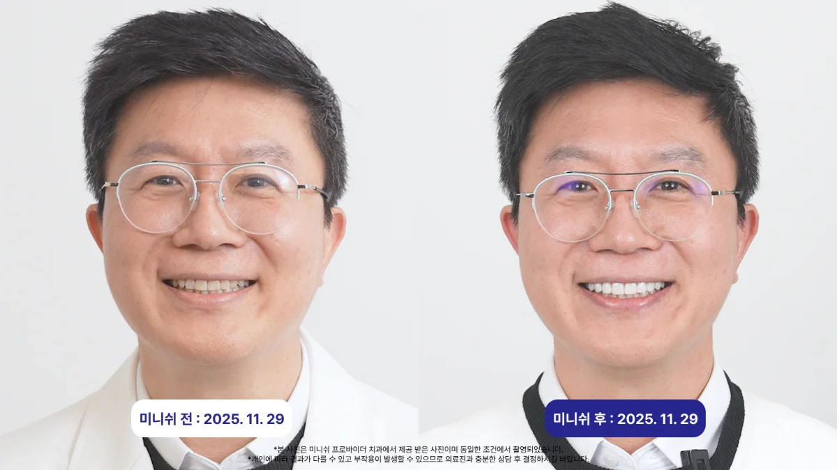 미니쉬전후_강정호대표님