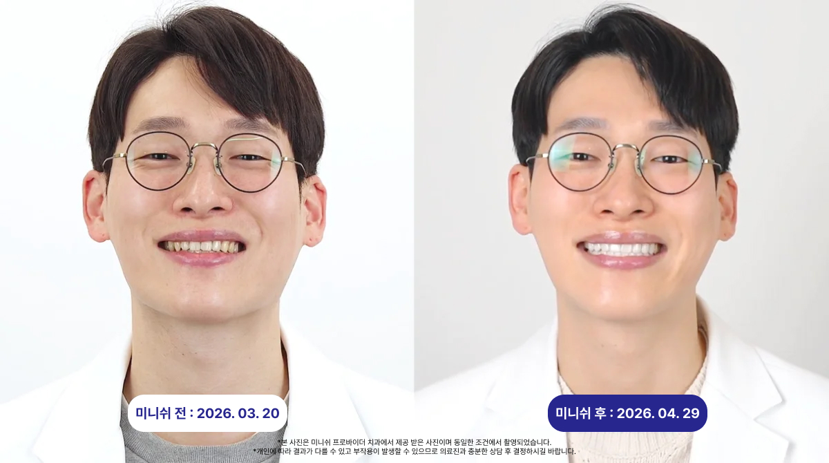 미니쉬전후_곽해성원장님
